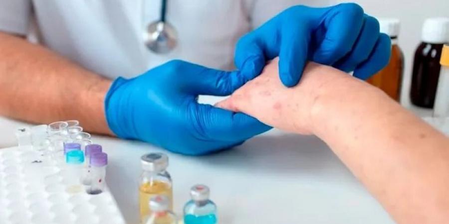 نتائج مُبشرة.. روسيا تكشف عن "لقاح جديد" لسرطان الجلد